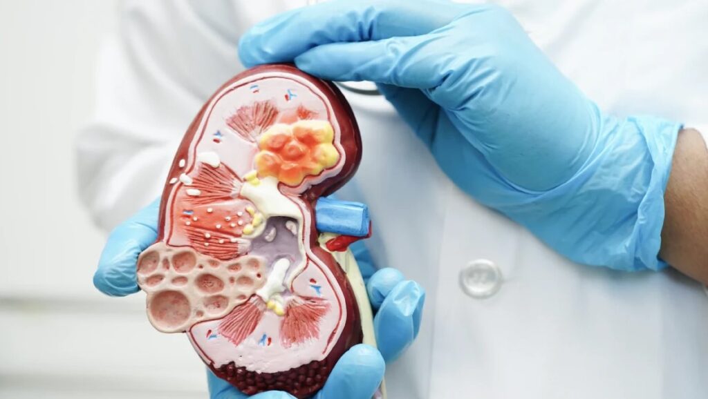 Urología